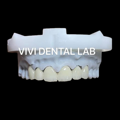 تاج و پل شفافیت 3D پرو