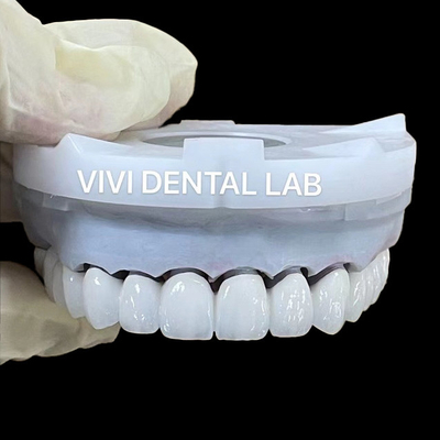 تاج هاي آزمايشگاهي دندانپزشکي زيرکونيايي 3D پرو PFZ پورسلين نوريتک