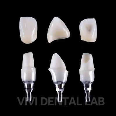 ایمپلنت دندان Tibase Zirconia Abutment تیتانیوم دقت سفارشی