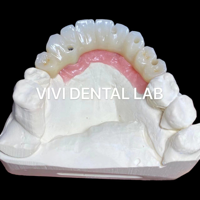PMMA دقت پل زیرکونیا کامل بر روی چند واحد Abutments