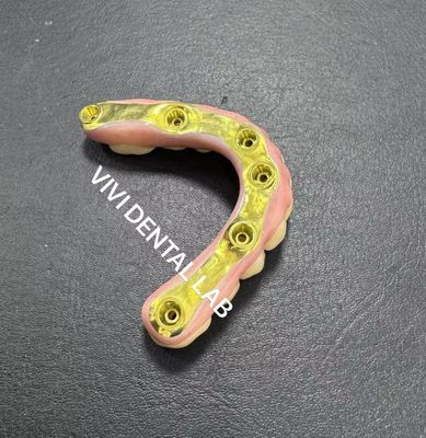 کل پل زيرکونيايي با تايتانيوم