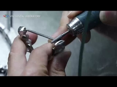 تاج ها و پل های PFM