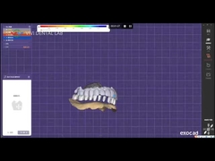 دندان مصنوعی انگشت