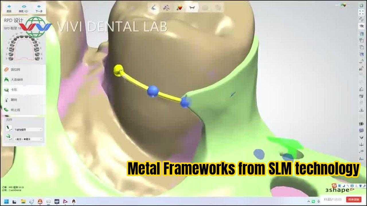 چین VIVI DENTAI LABORATORY گواهینامه ها