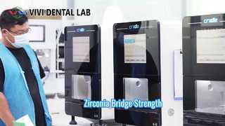 زیرکونیا بریج استرانگ استتیک VIVI Dental Lab